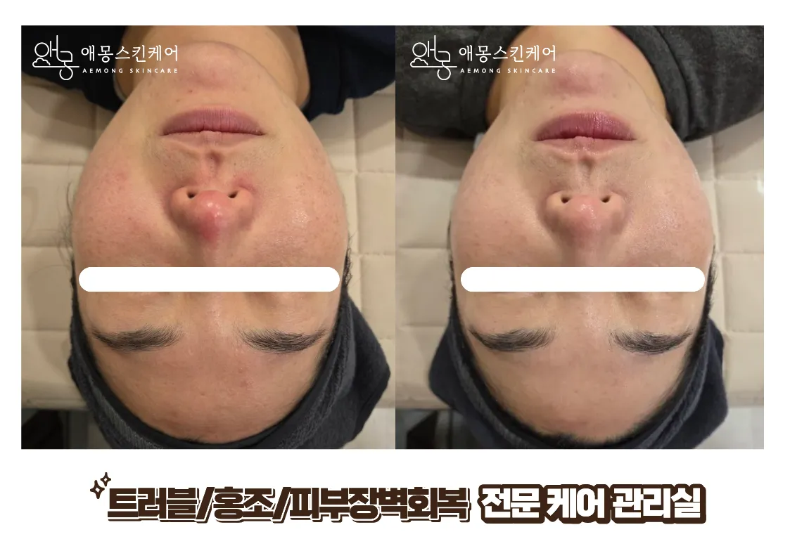 [용인시] 애몽스킨케어