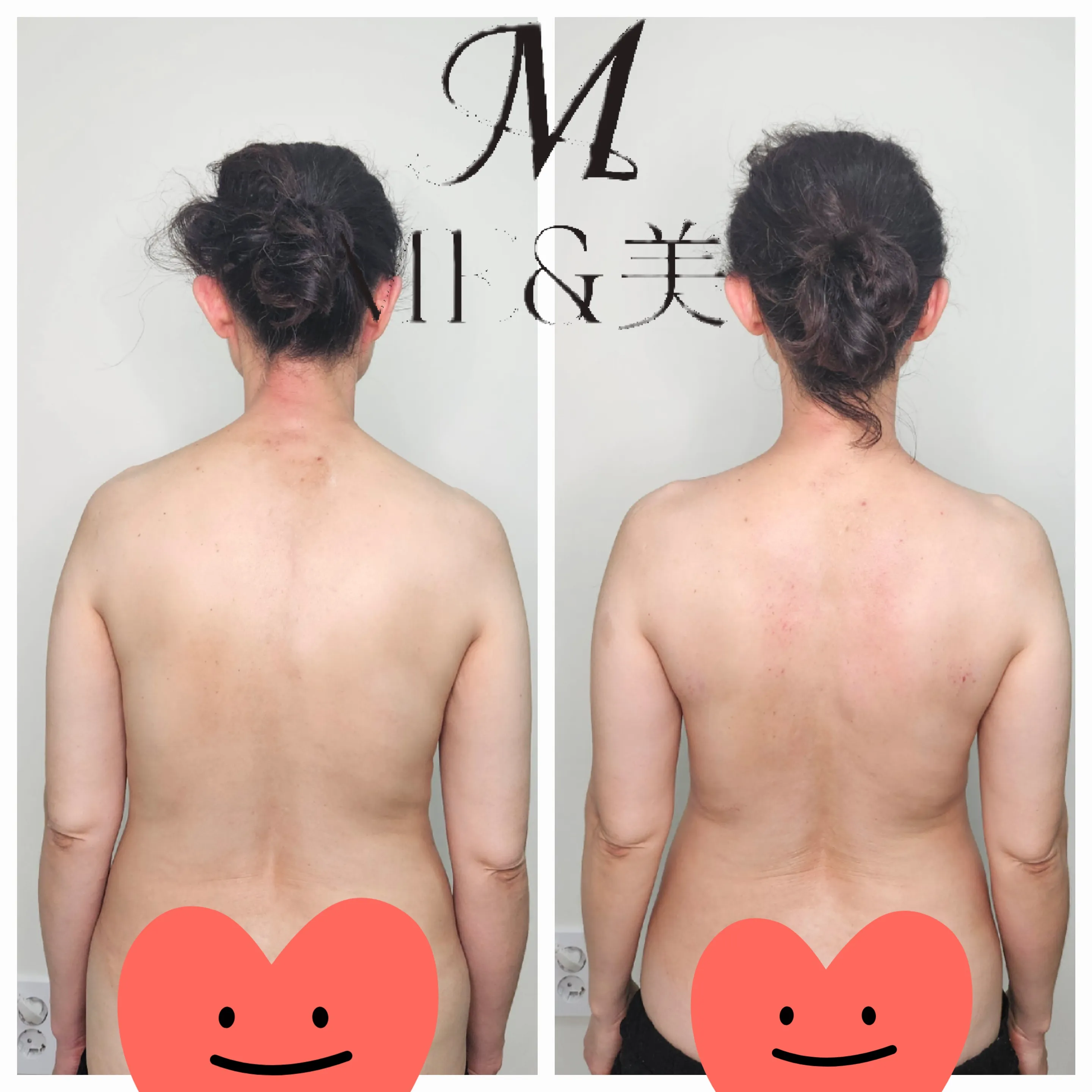 [양산시] 미앤미 스킨앤바디