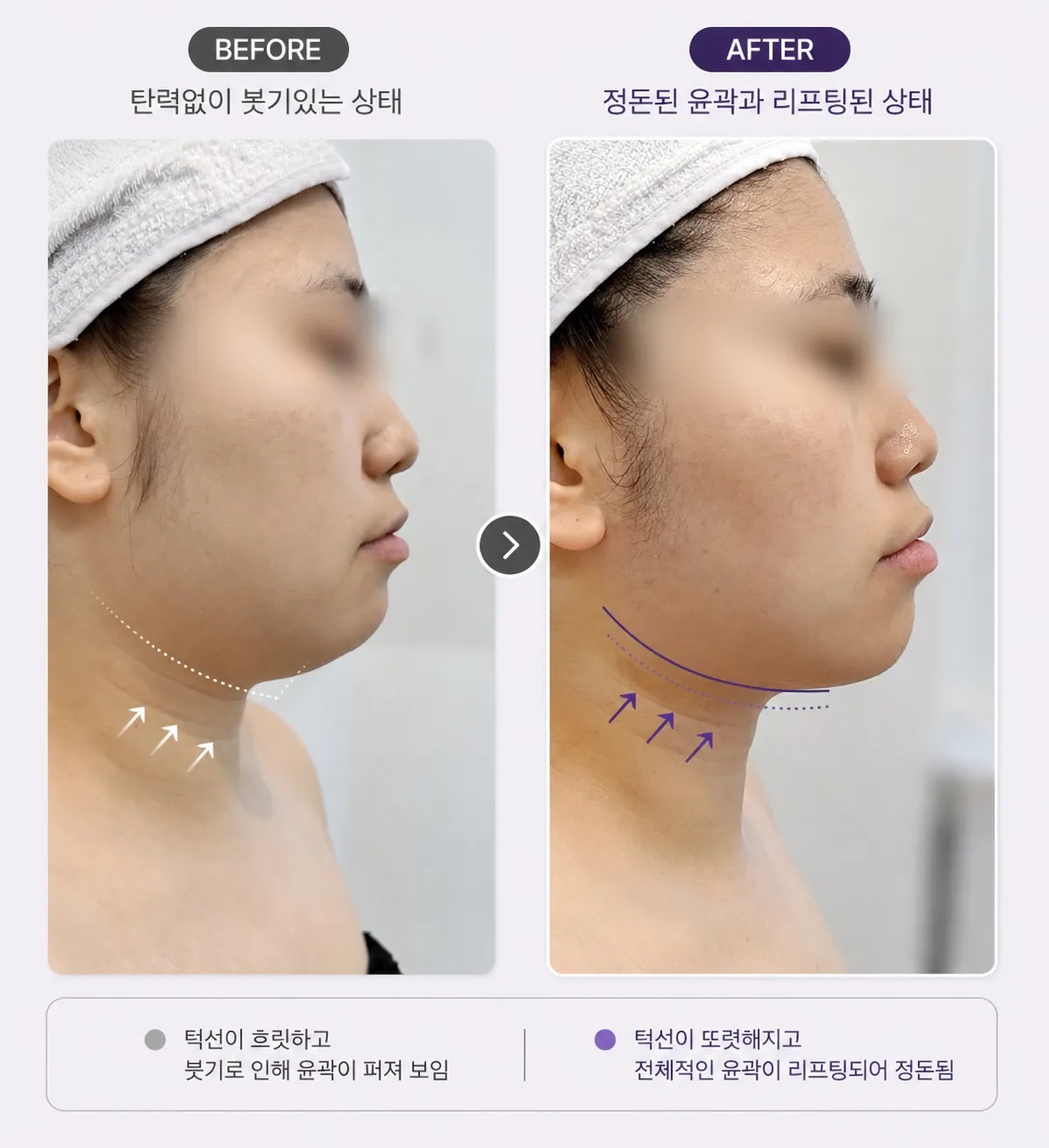 [의정부시] 채온에스테틱