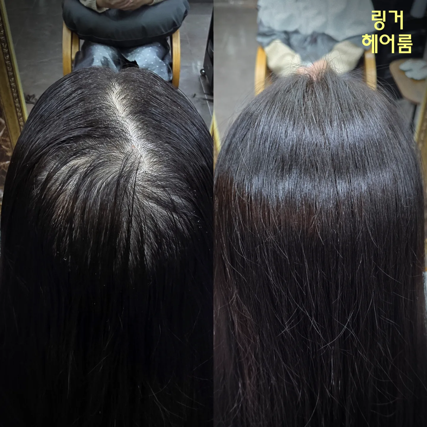 [성북구] 링거 헤어룸