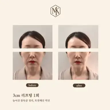[성북구] 엠케이에스테틱