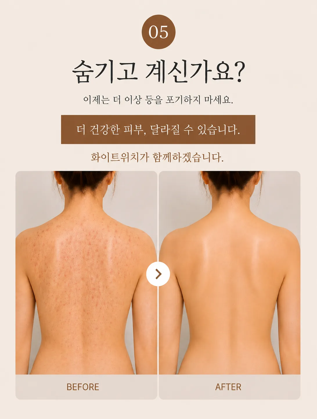 [남동구] 화이트위치 인천