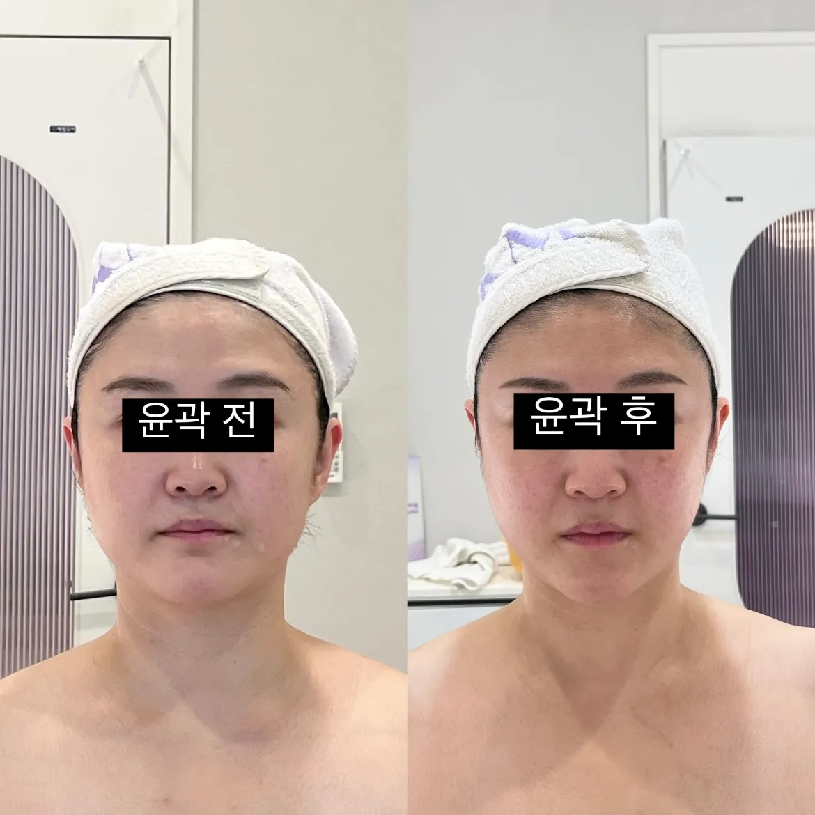 [강서구] 케이엠에스테틱 마곡점
