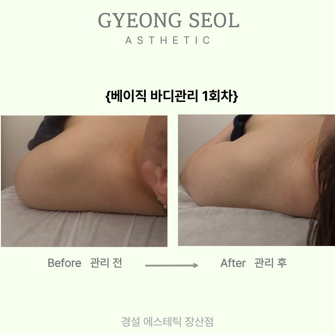 [해운대구] 경설 에스테틱