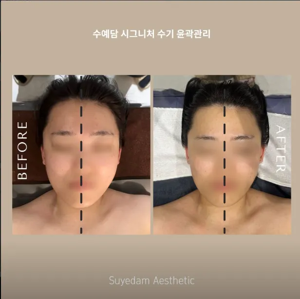 [아산시] 수예담 에스테틱 천안아산점