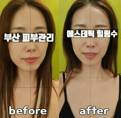 에스테틱힐링수