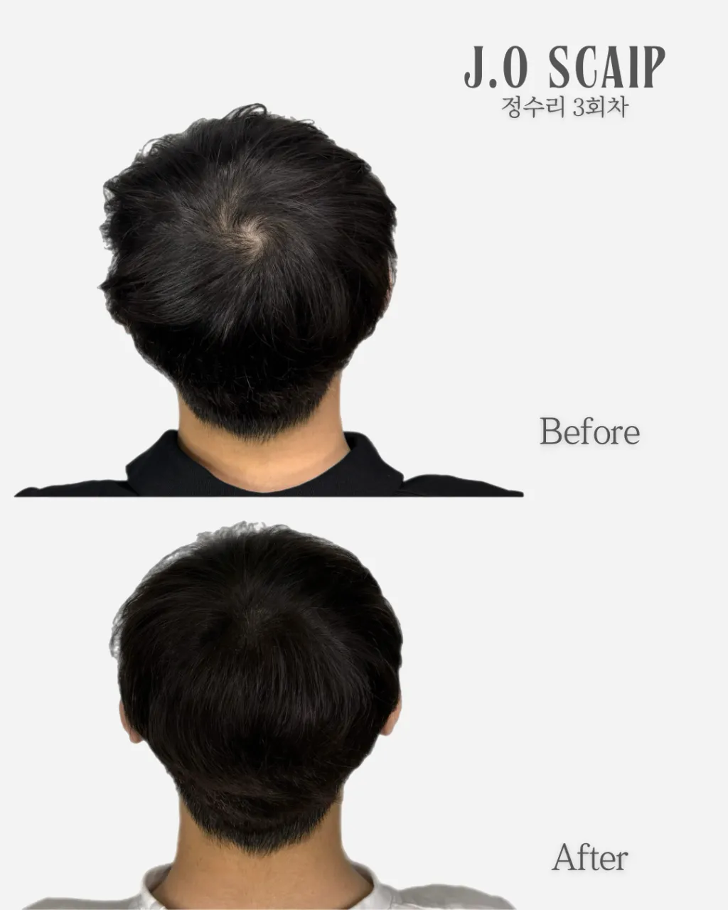 [연제구] 제이오스칼프