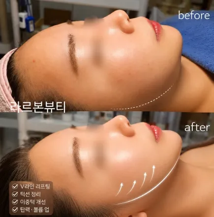 [서대문구] 라르본뷰티 아현점