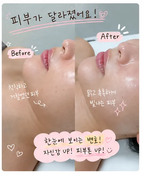 [전주시] 르빛에스테틱