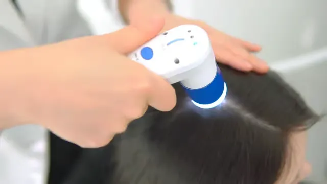 [천안시] 탑스칼프 천안