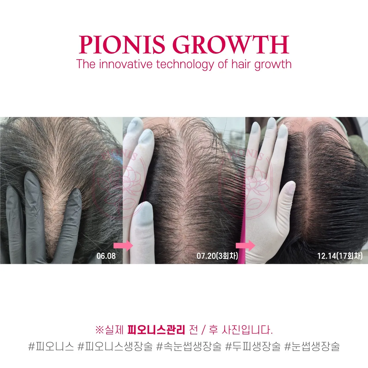 [군포시] 유우도트