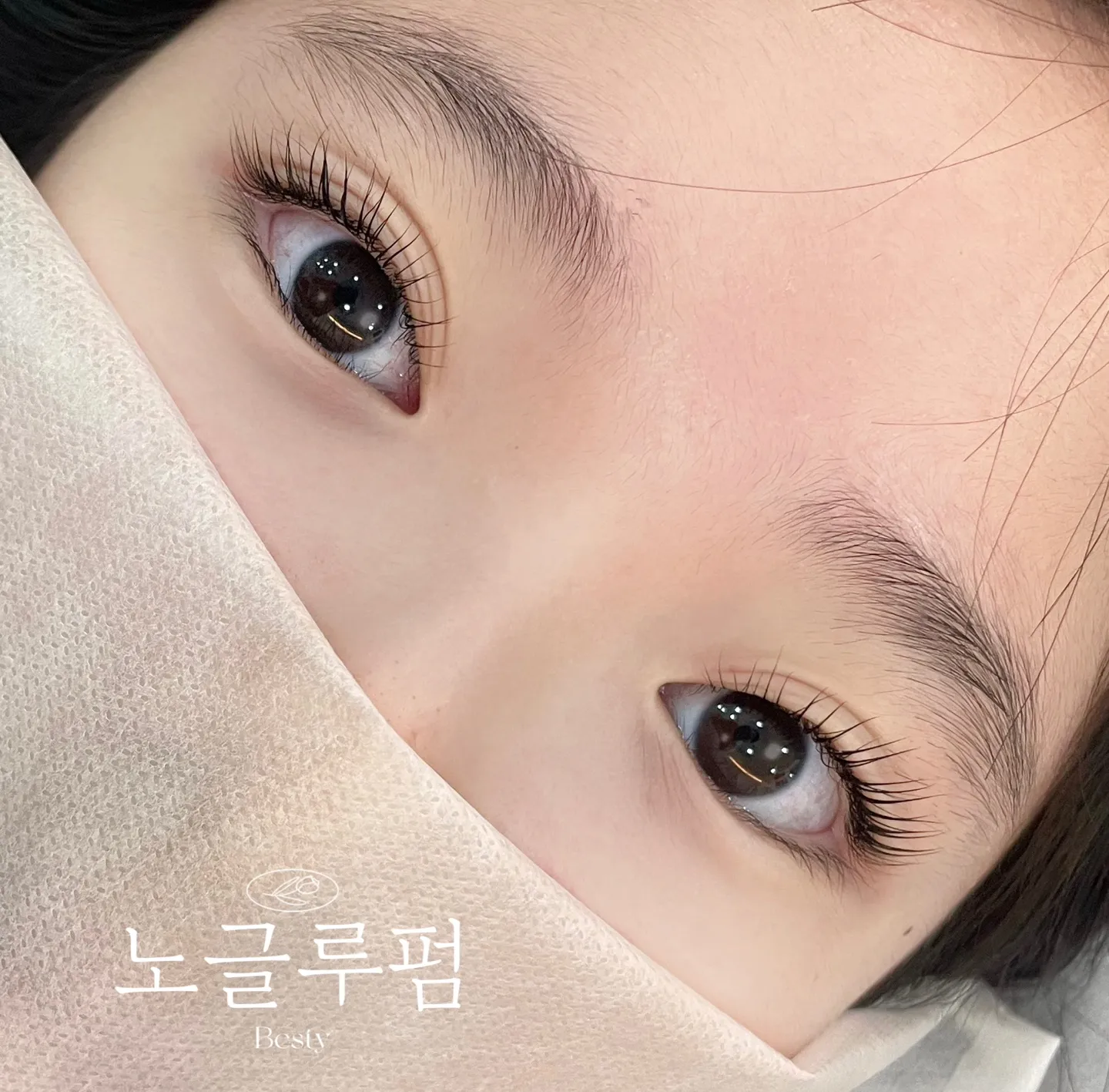 베스티 이미지