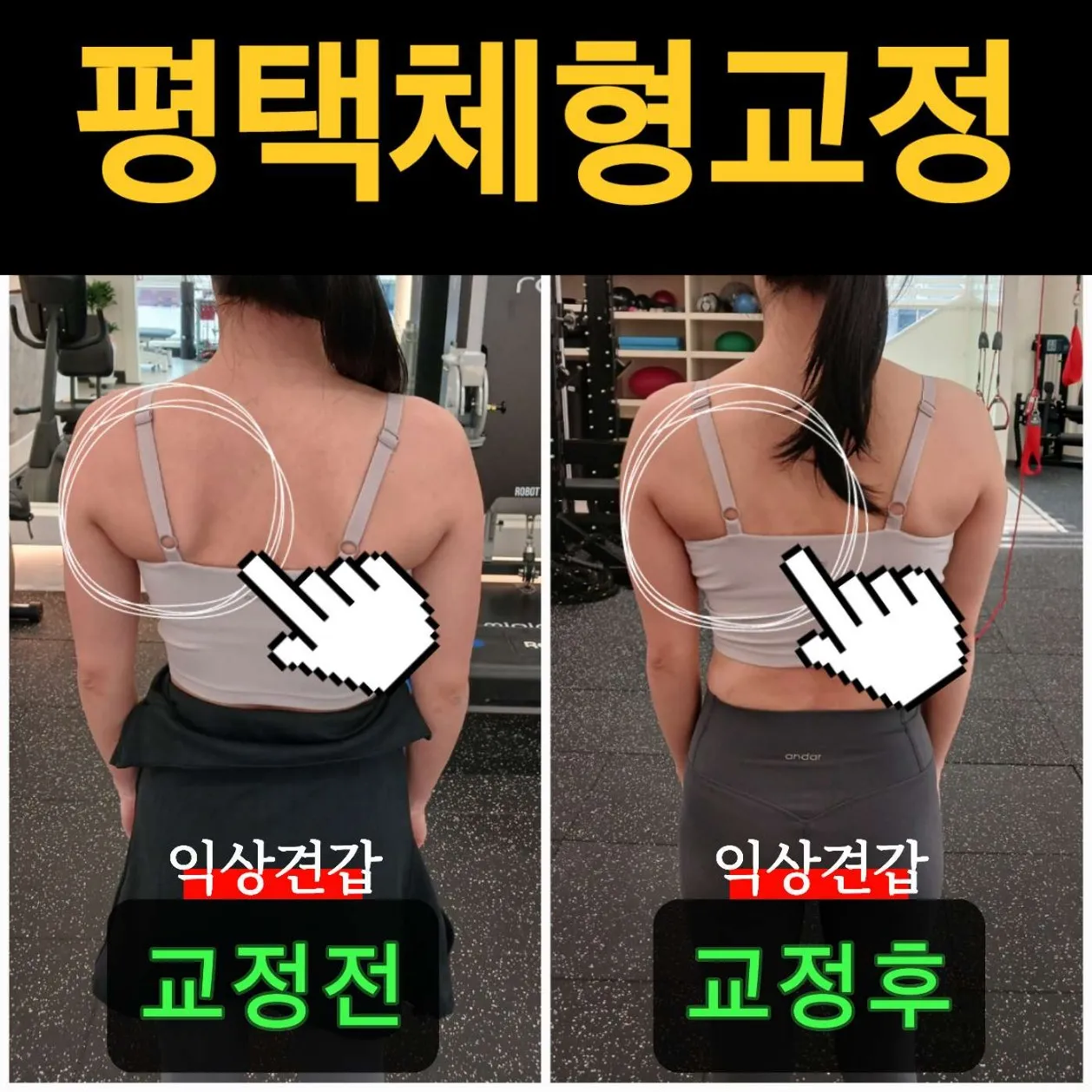 [평택시] 필라테스 재활PT체형교정 백년관절운동센터 평택점