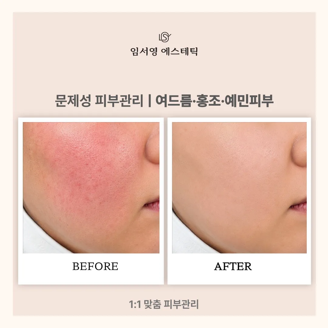 [전주시] 임서영에스테틱