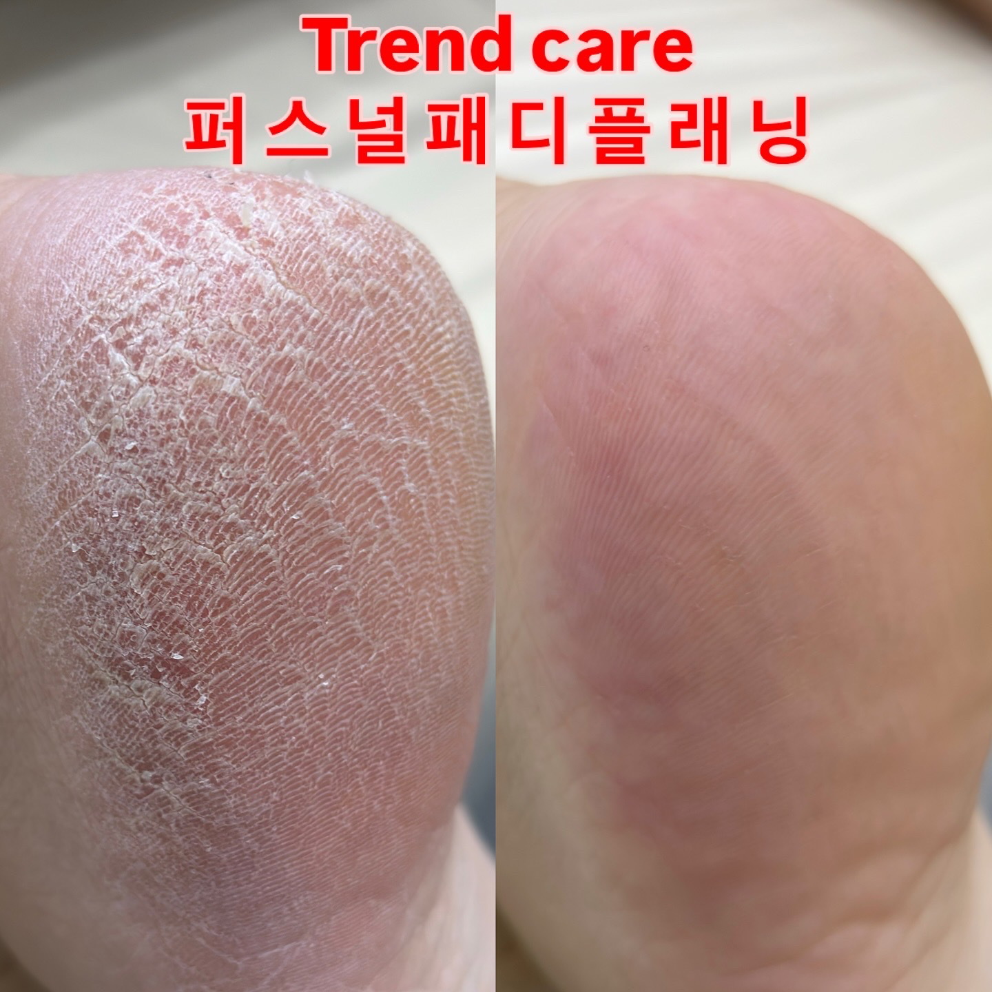 고양이발톱 대구본점