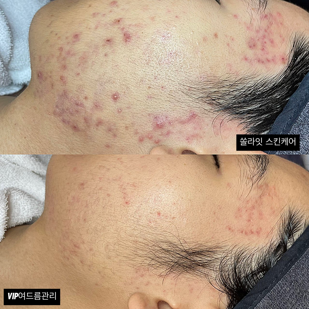 [안산시] 쏠라잇스킨케어