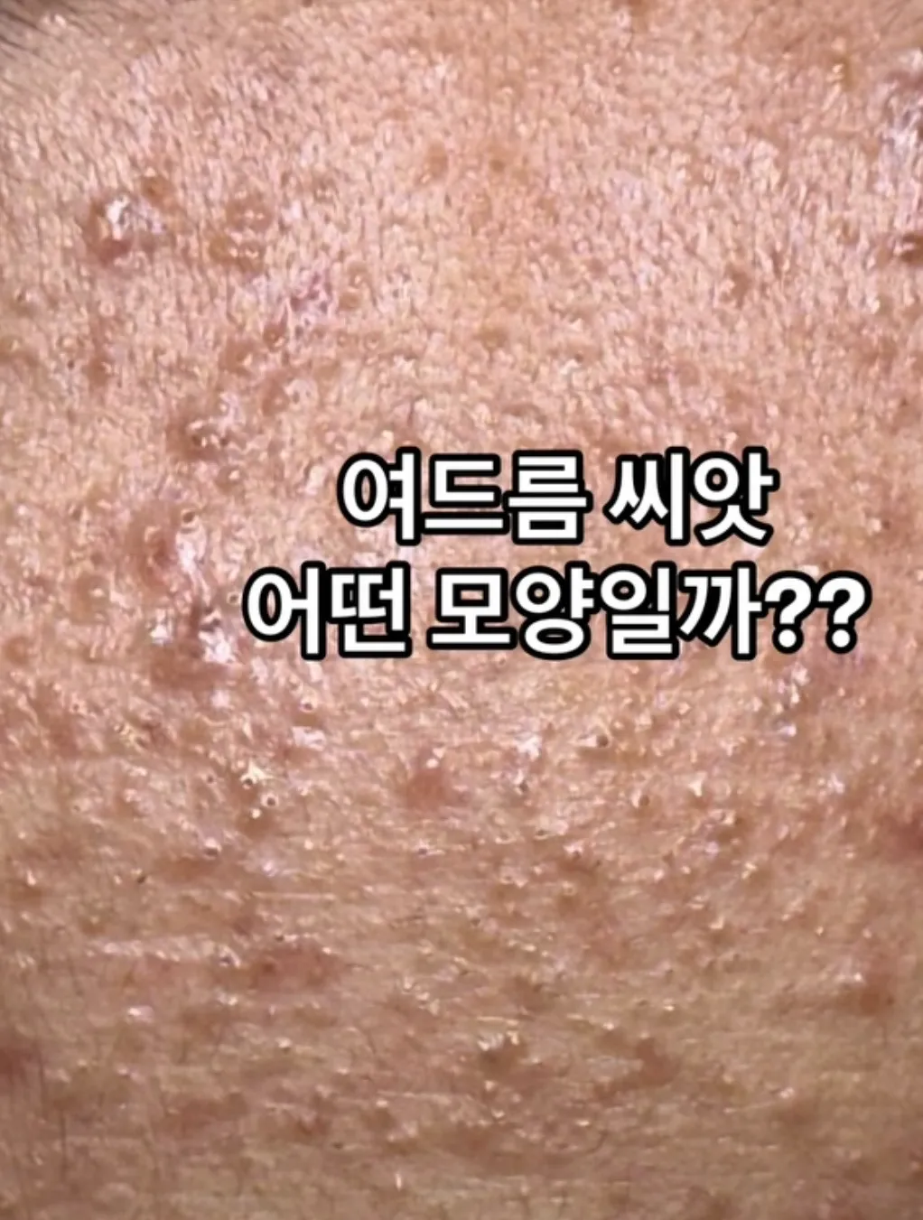 [성북구] 얌얌스킨앤슈가링