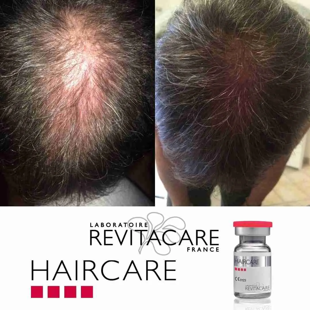 REVITACARE HAIRCARE ( 10 X 5ML) - Image 2