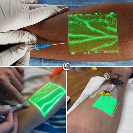 VEIN  FINDER - XZPK 103 - Image 2