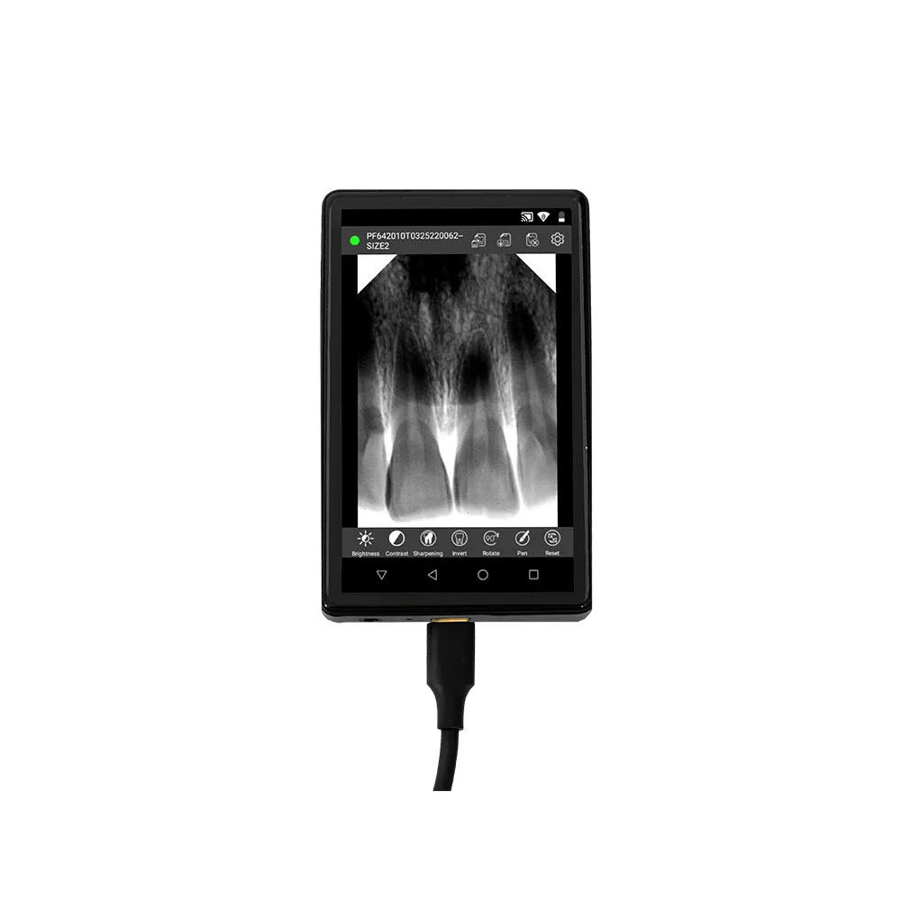 Portable Digital Imaging System