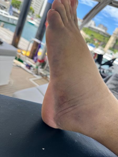The FOOT Experience