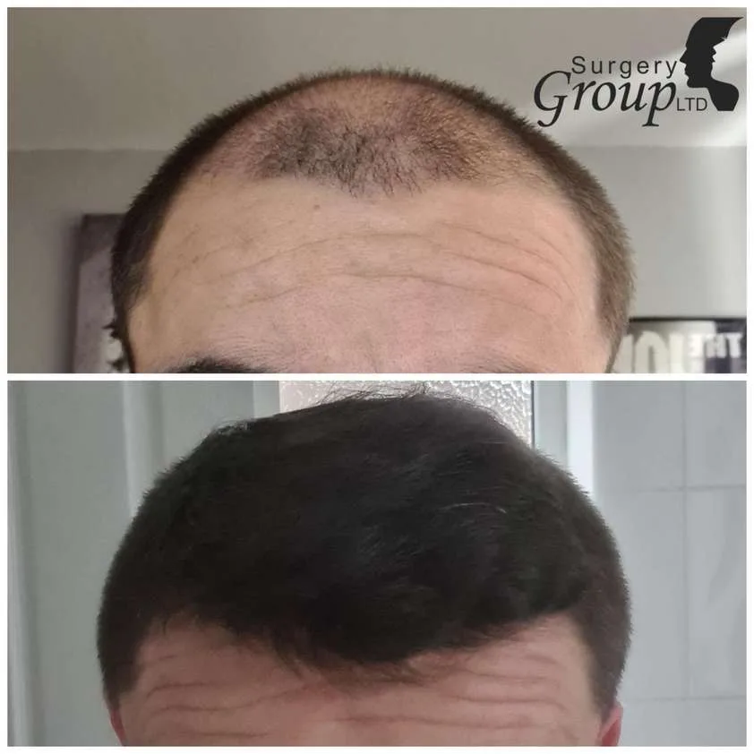 Patient before and after result