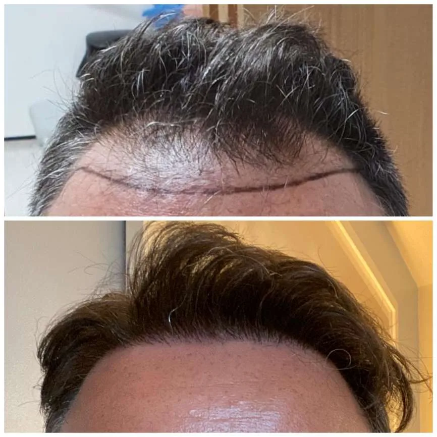 Patient before and after result