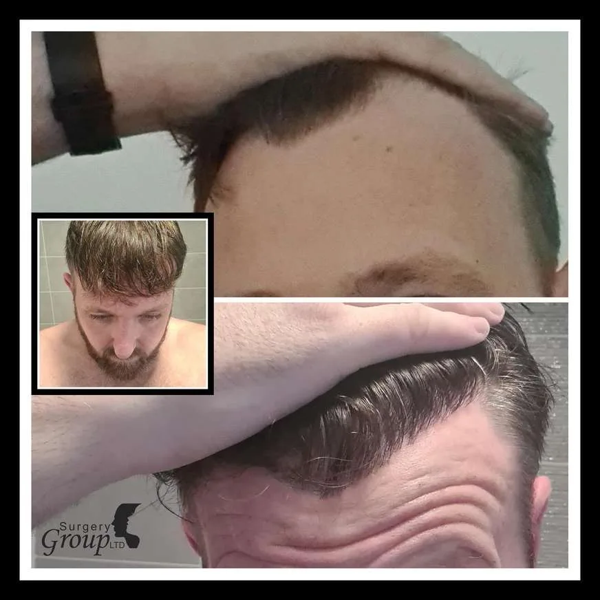 Patient before and after result
