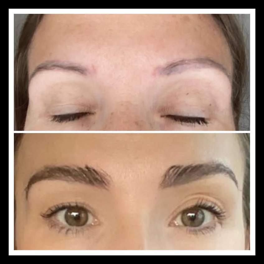 Patient before and after result