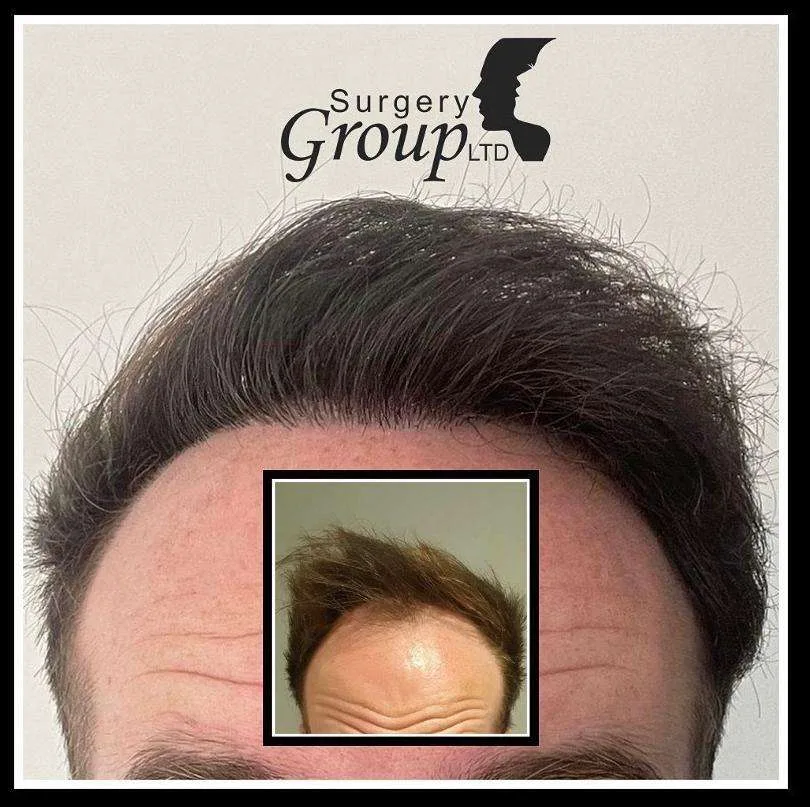 Patient before and after result