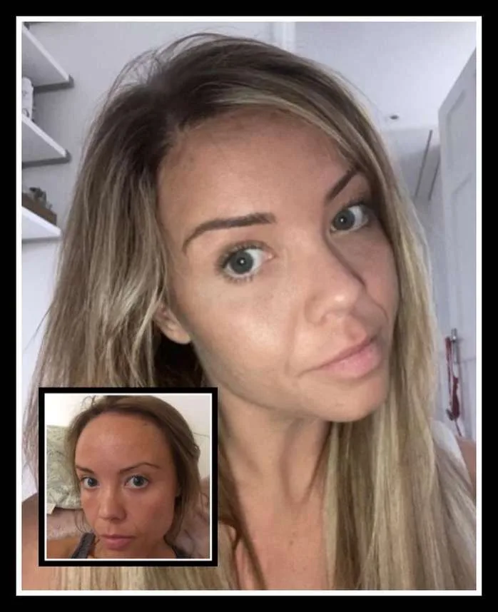 Patient before and after result