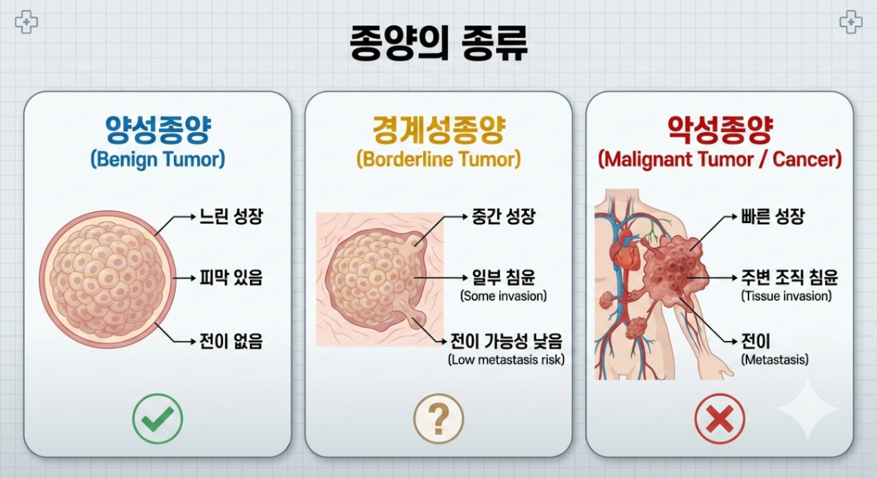 종양의 종류 안내용 이미지