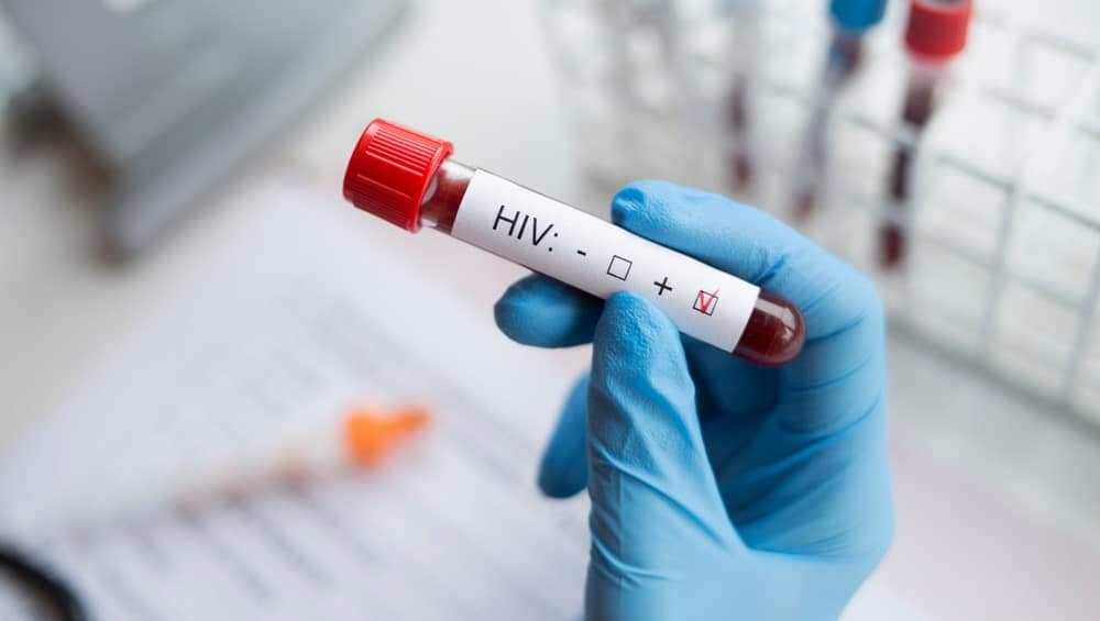 Uyuşturucu Nakli İçin Kan Paylaşımı: HIV Riski Taşıyan Akılalmaz Yöntem