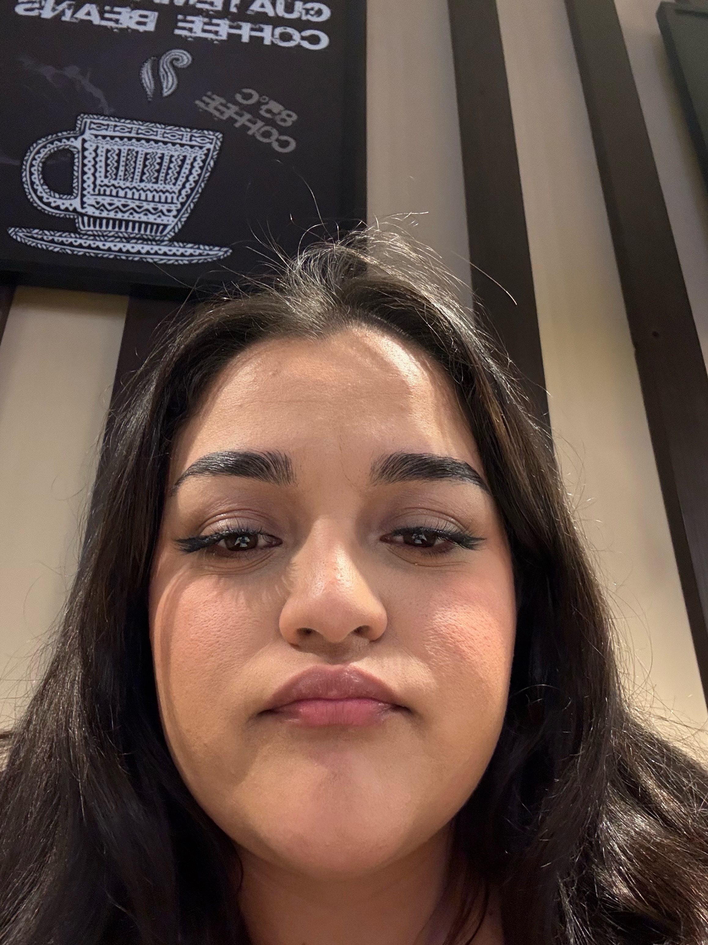 xio