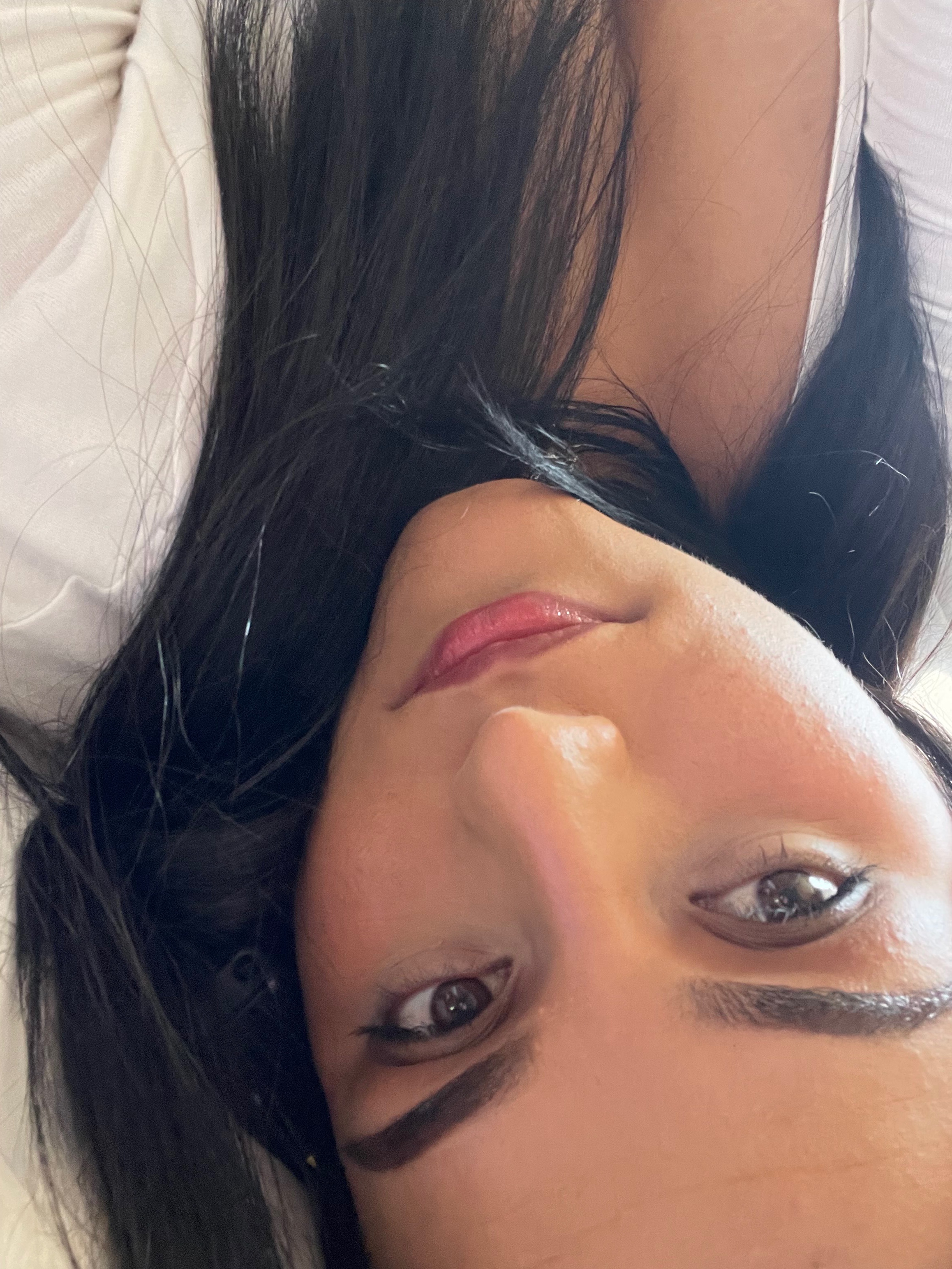 xio