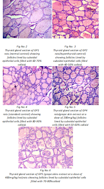 Anti Thyroid and Anti Oxidant Effects of Grape Skin Extract on L-Thyroxine Induced Hyperthyroidism in Rats