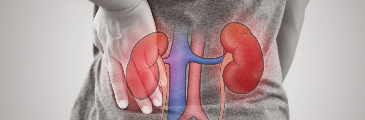 Understanding Urinary Tract Infections (UTIs)