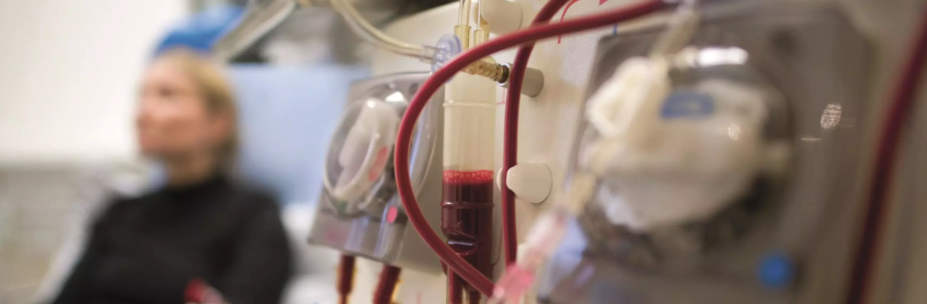 Dialysis