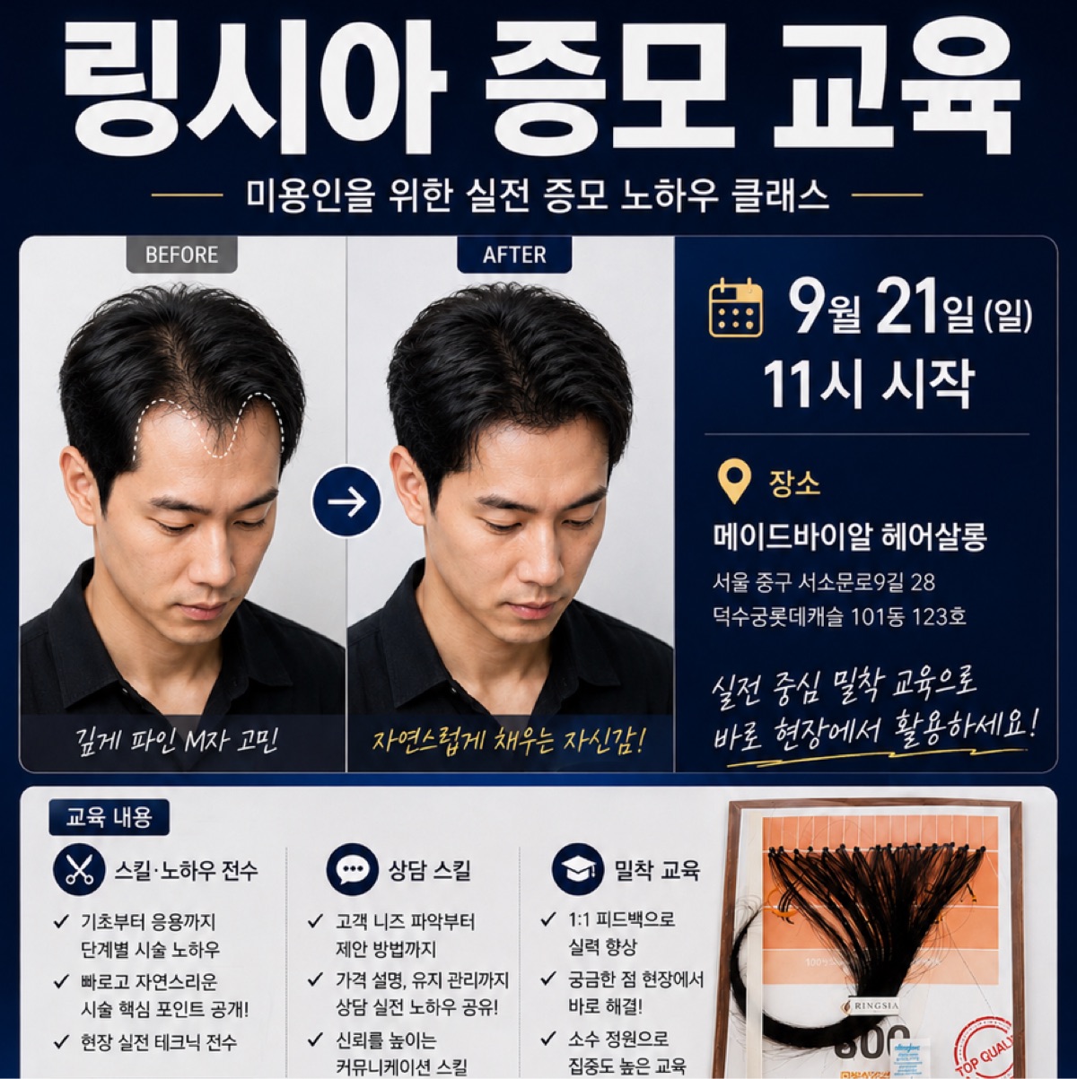 남자 m자 탈모 증모교육