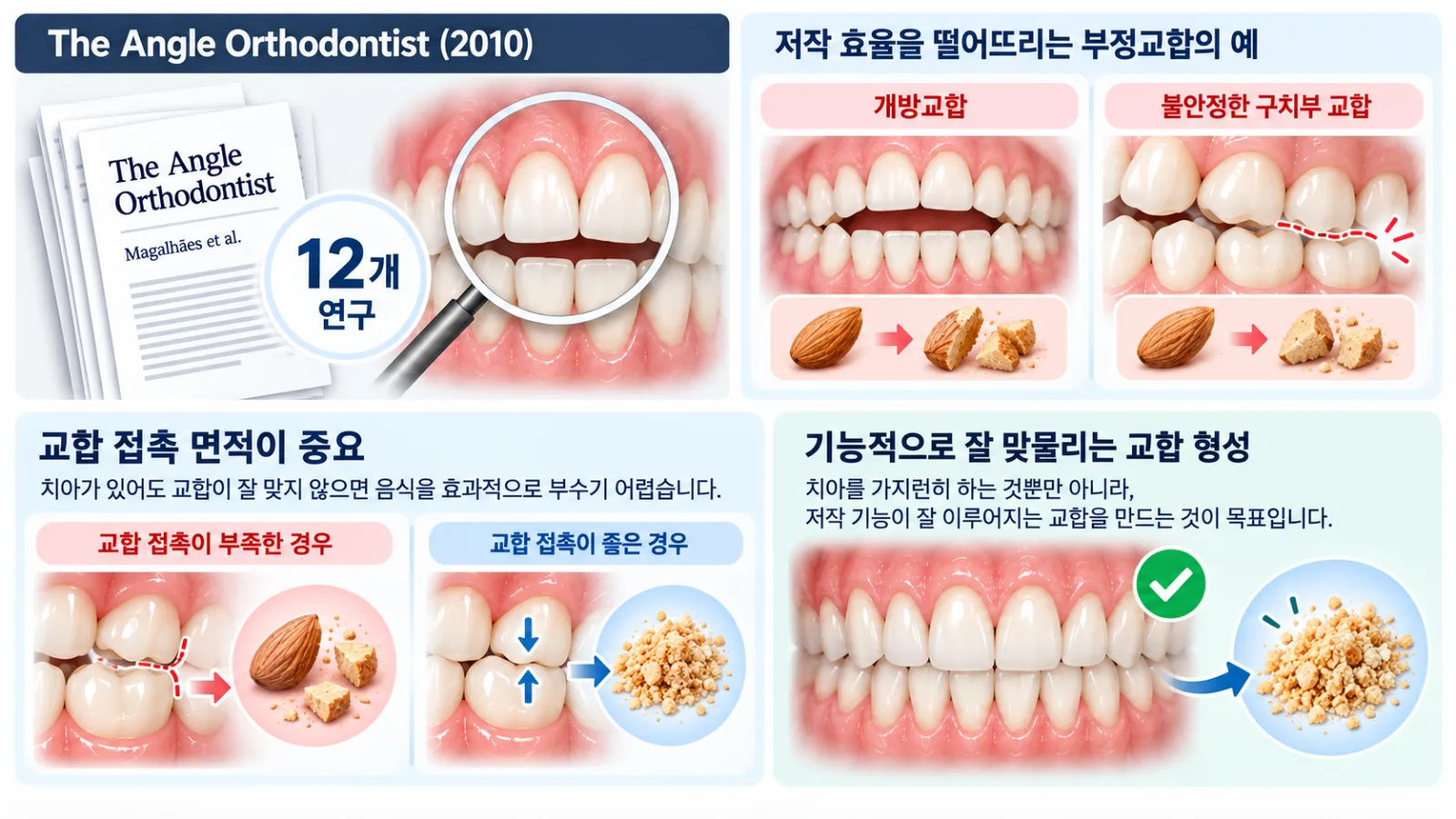 교합과 저작 효율 치과 인포그래픽