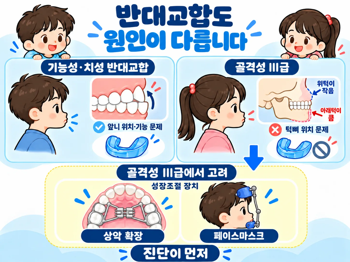 반대교합 원인과 치료 인포그래픽