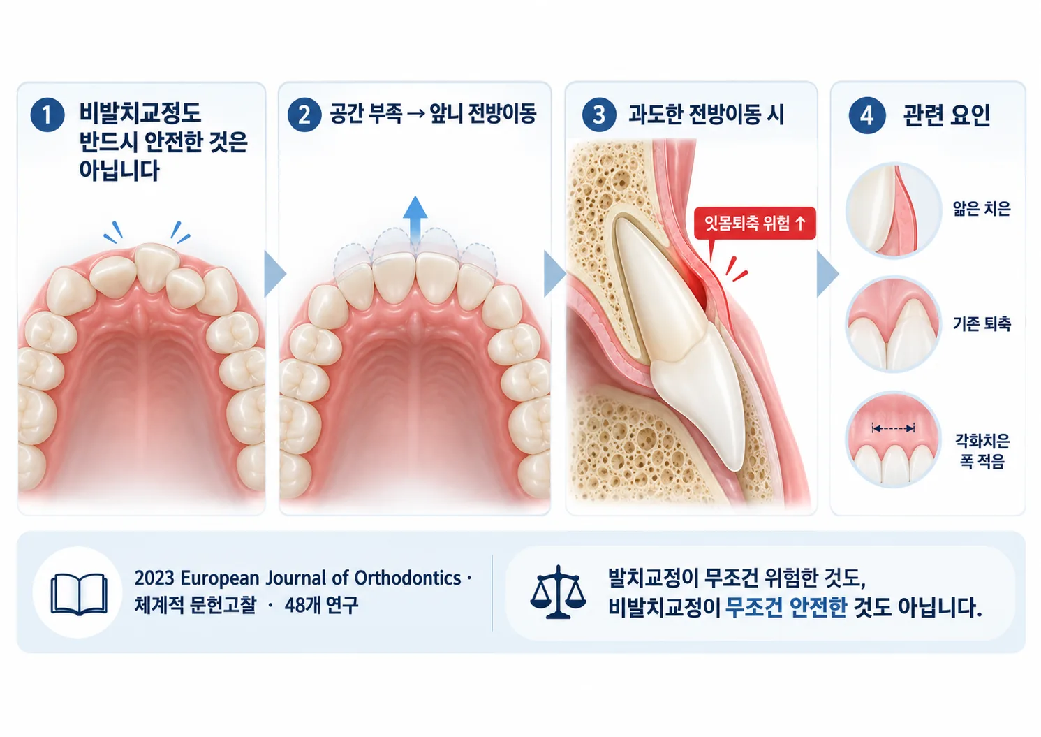 비발치교정과 잇몸퇴축 위험 인포그래픽