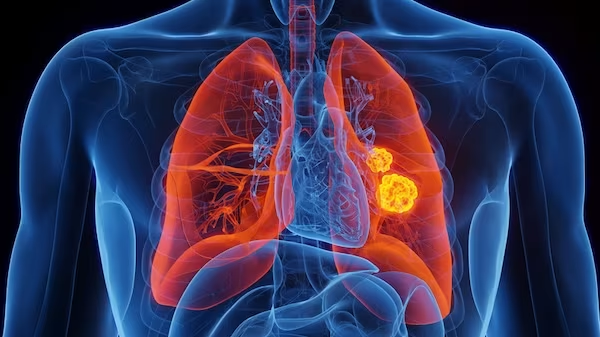 Cancer experts demand a law to hold ministers to account over deadly treatment delays