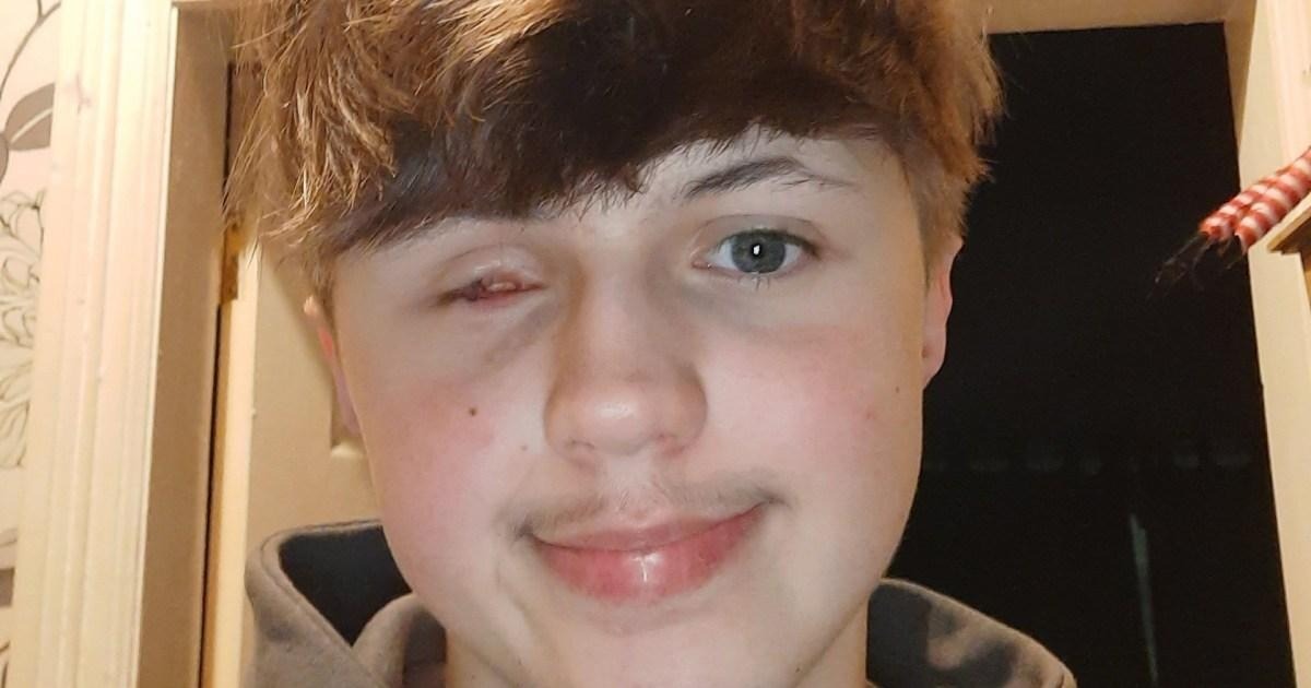 Aleks Stasiukiewicz, 17, of Hartlepool, whose mother Julie rushed to the scene after receiving a call from a friend she initially took for a joke.