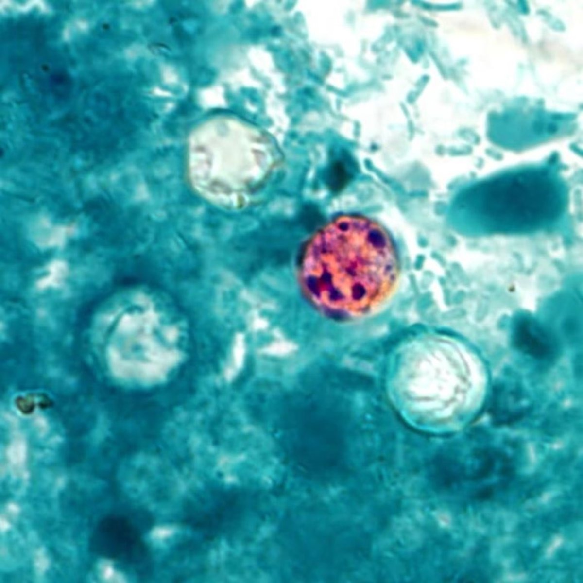 FDA finds cyclospora parasite at Mexican Taylor Farms site but closes investigation without explaining how it contaminated lettuce
