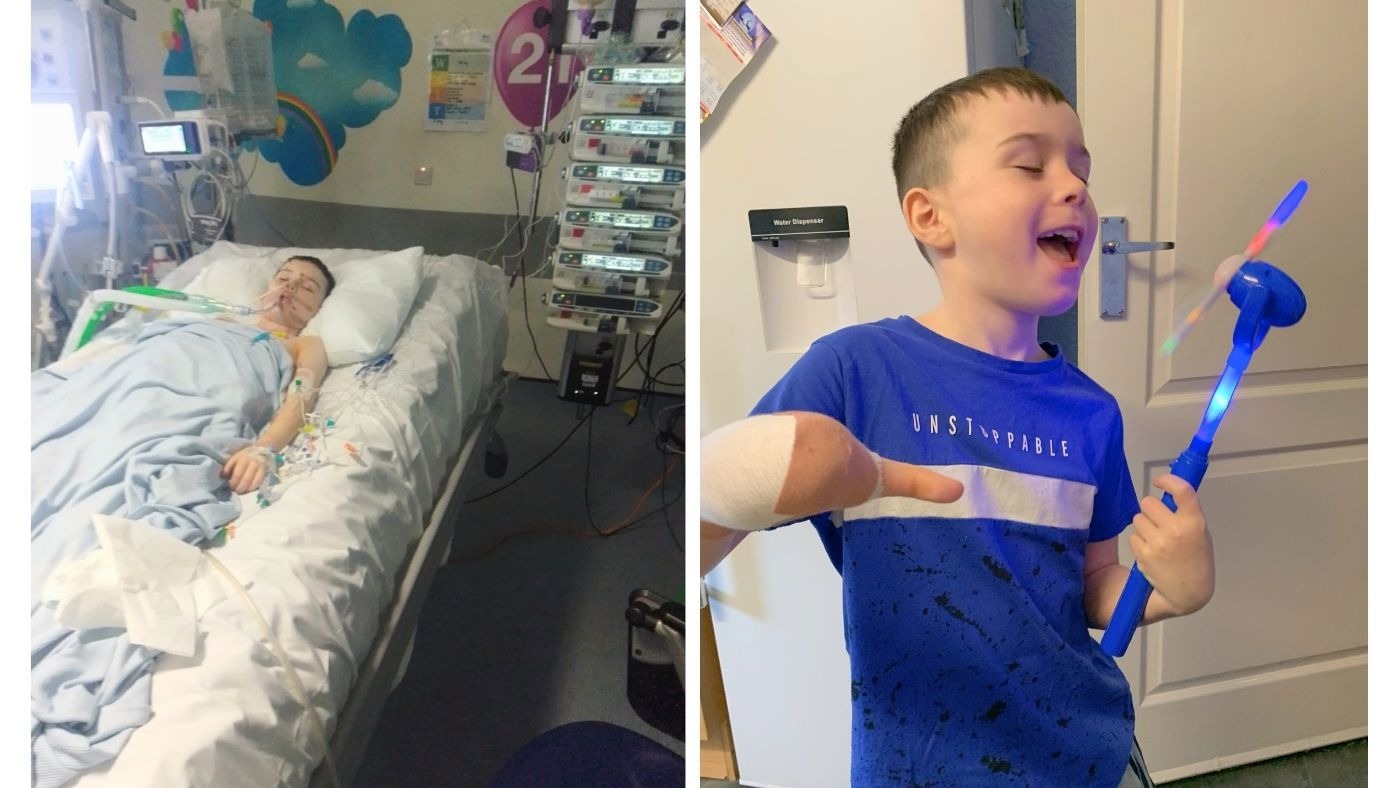 Riley Luke, now 12, needed help dressing, cutting food and writing as he recovered after a firework stuck to his palm and exploded within seconds, blasting part of his hand away.