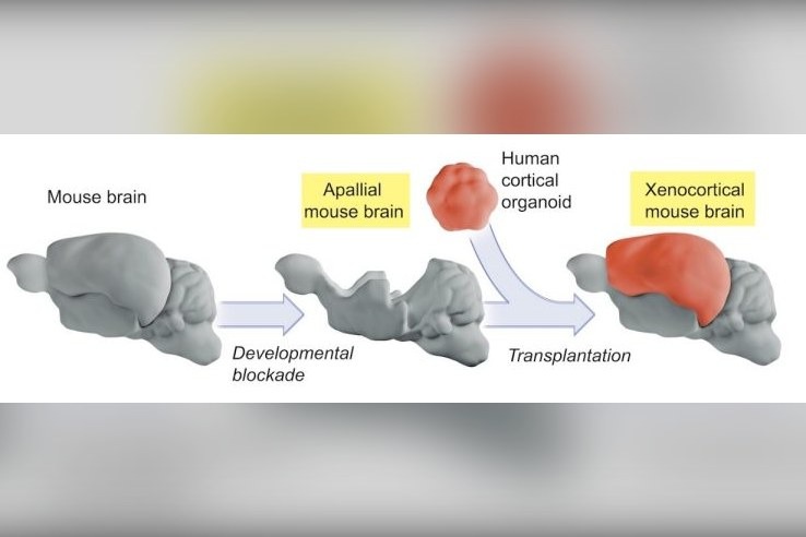 Human brain tissue grown in a Stanford laboratory and implanted into mice could let researchers test treatments for conditions including schizophrenia and epilepsy, where drugs often "fail dramatically in clinic.