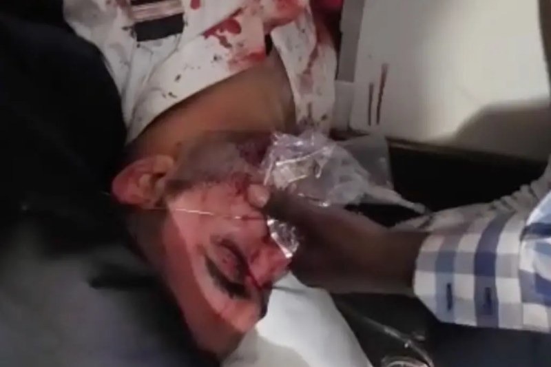 The injured Omani co-pilot, who Israeli Prime Minister Benjamin Netanyahu said had undergone "Islamic radical indoctrination" and was suicidal, with Israel probing whether the attack was state-sponsored.
