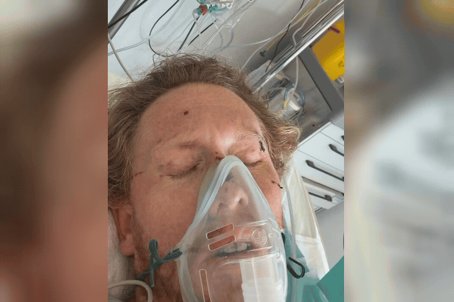 Kyle Quin Schrock, 36, from San Diego, who says 'my back is broken, my ribs are broken, my sternum is broken' after falling 200ft from a cliff path in Madeira on October 11.