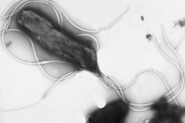 H. pylori, the stomach bug the NHS estimates infects four in ten UK adults, was the single biggest infection-linked cancer culprit, responsible for 760,000 new cases in 2024.